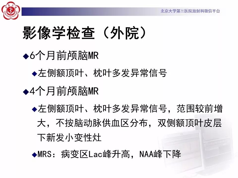 【病例】线粒体脑肌病1例MR影像表现