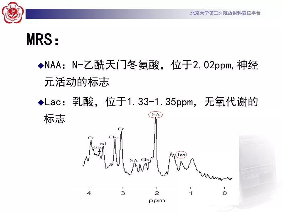 【病例】线粒体脑肌病1例MR影像表现