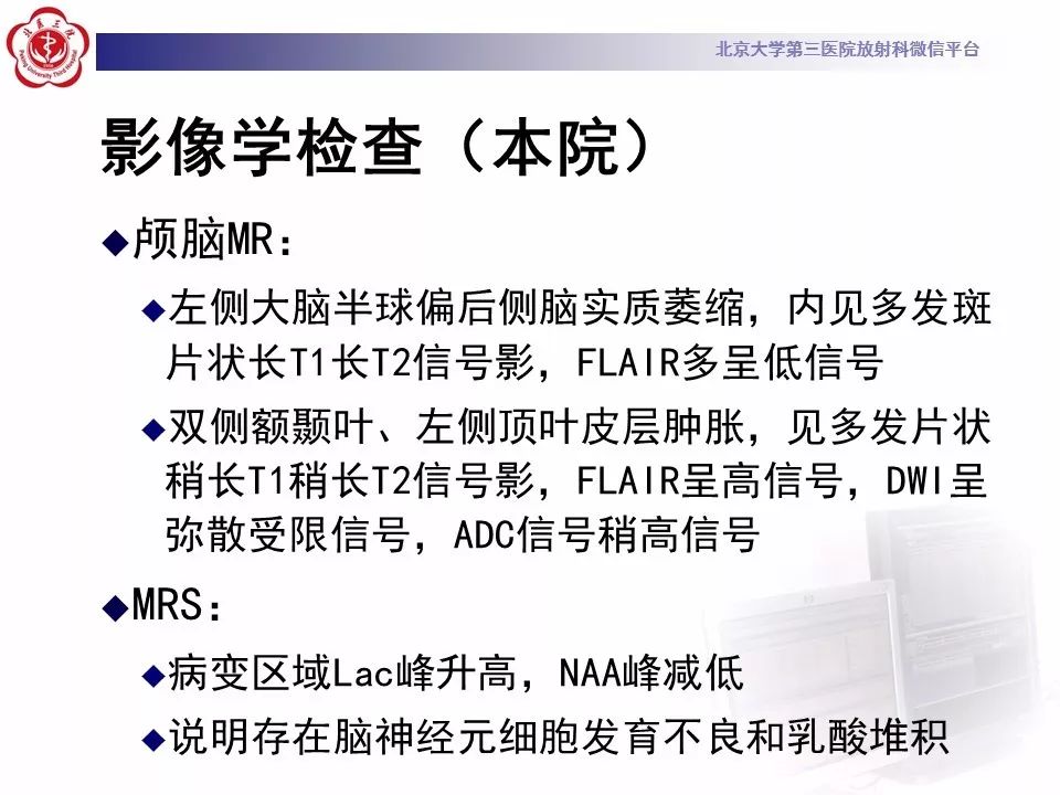 【病例】线粒体脑肌病1例MR影像表现