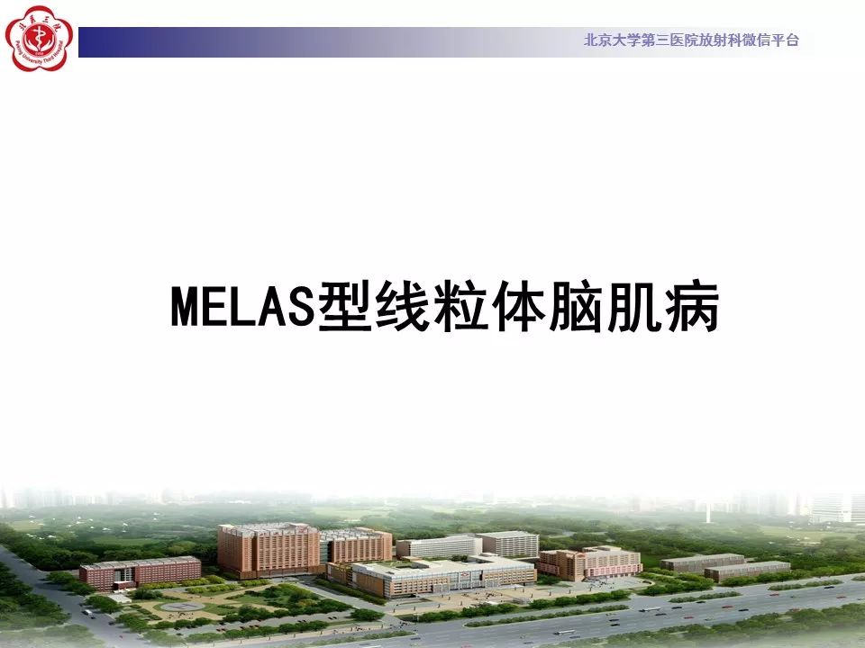 【病例】线粒体脑肌病1例MR影像表现