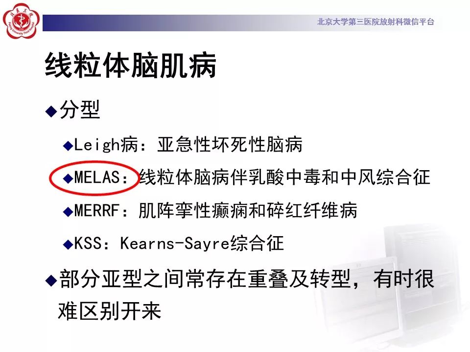 【病例】线粒体脑肌病1例MR影像表现