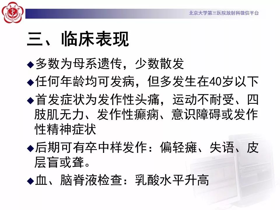 【病例】线粒体脑肌病1例MR影像表现