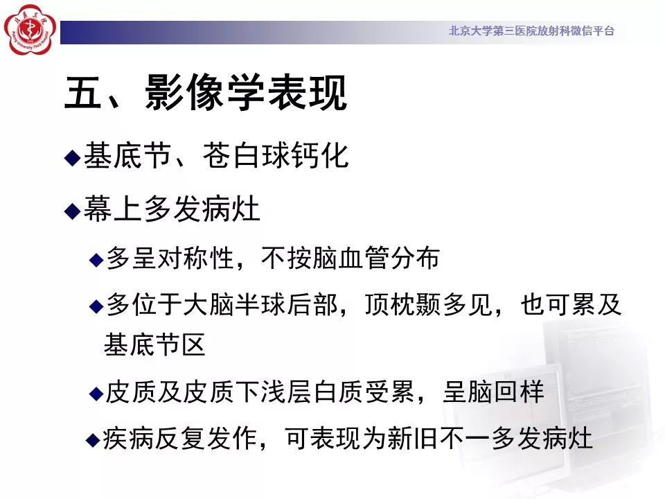 【病例】线粒体脑肌病1例MR影像表现