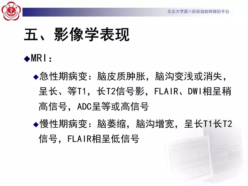 【病例】线粒体脑肌病1例MR影像表现