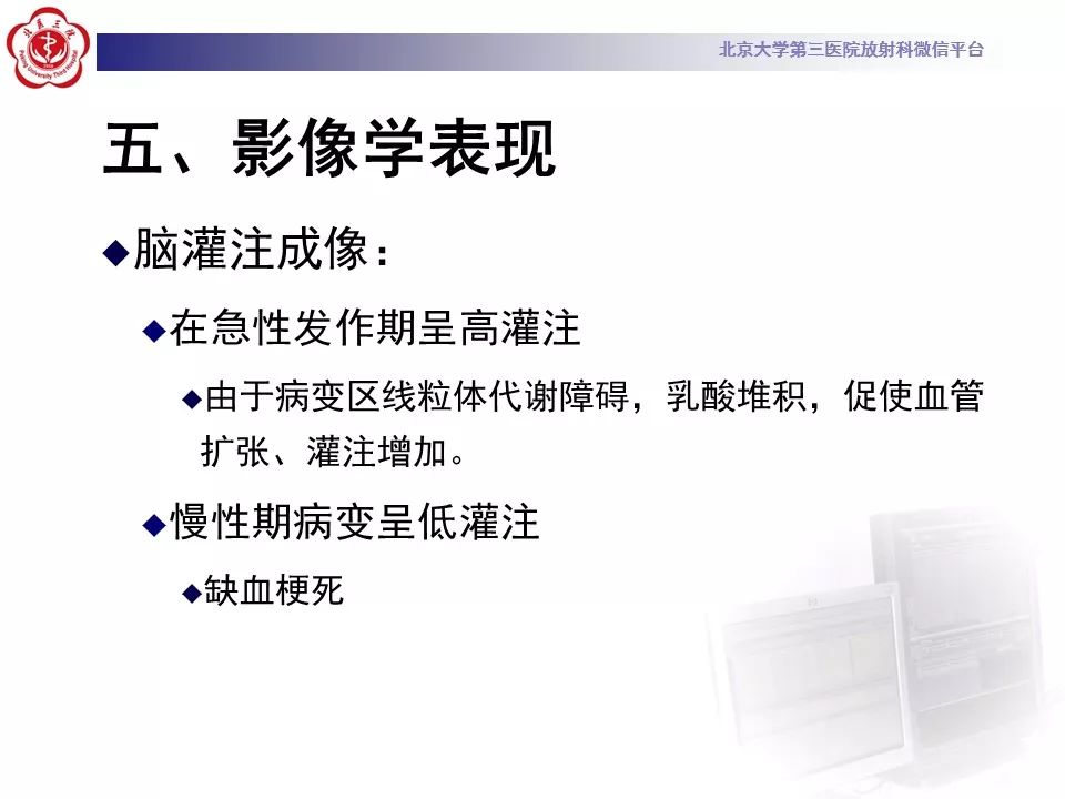 【病例】线粒体脑肌病1例MR影像表现