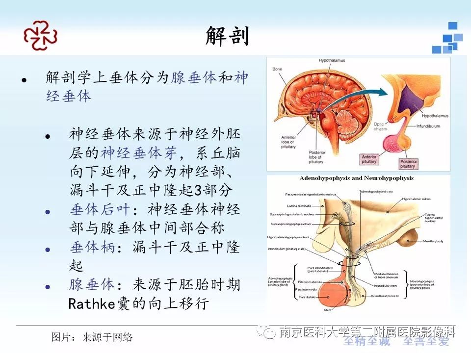 【PPT】垂体Rathke囊肿MRI表现