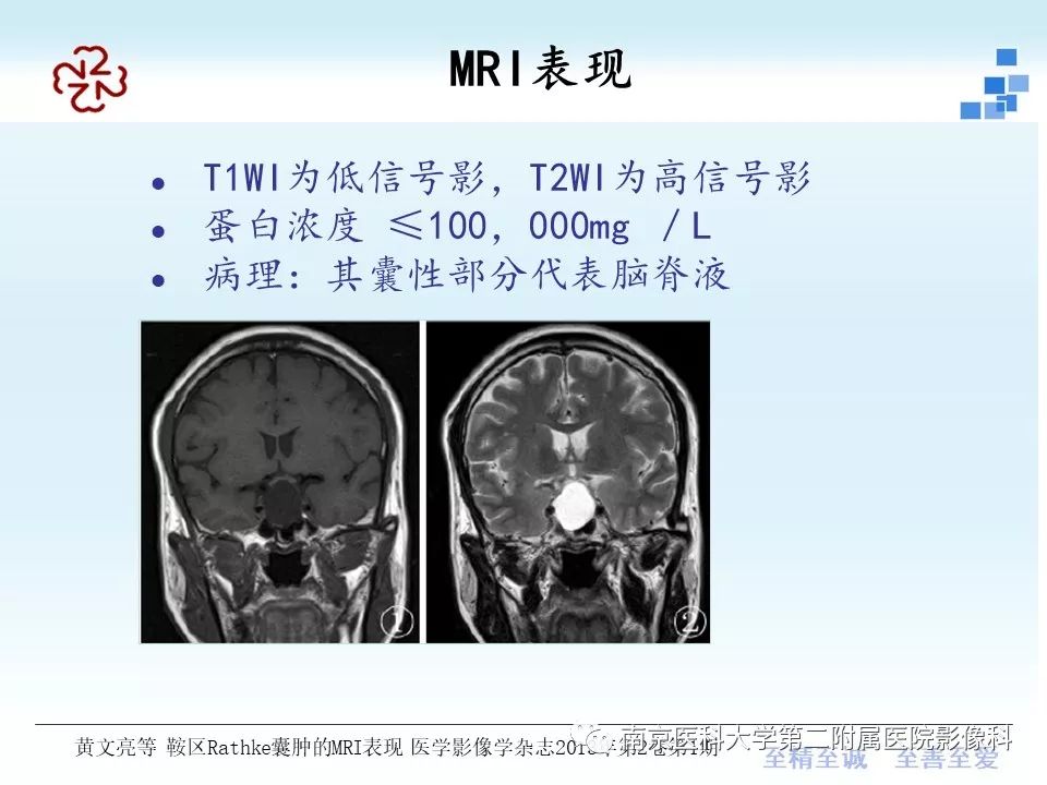 【PPT】垂体Rathke囊肿MRI表现