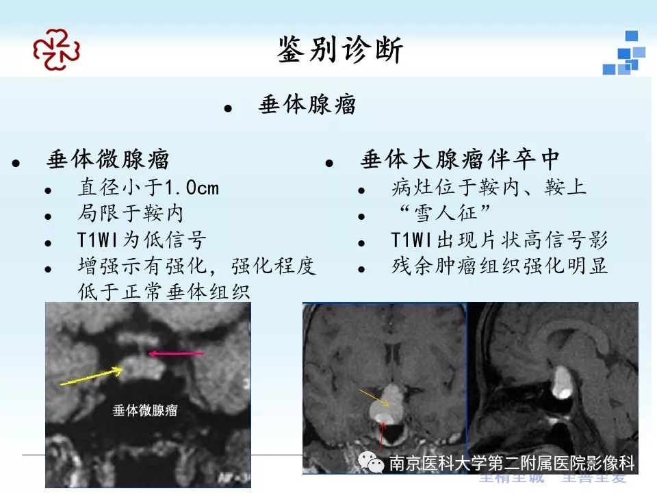 【PPT】垂体Rathke囊肿MRI表现