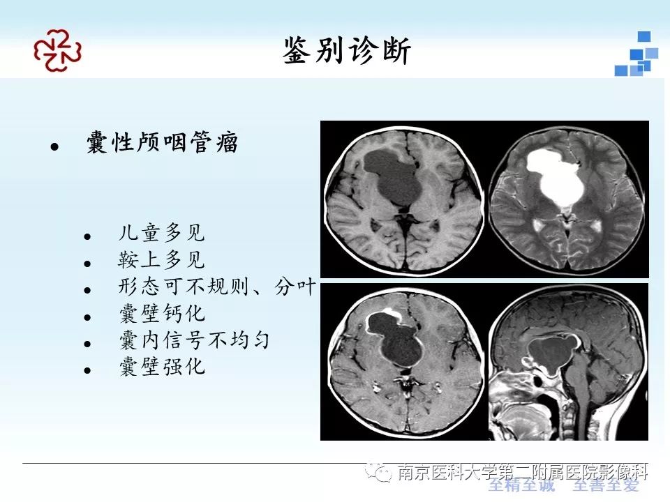 【PPT】垂体Rathke囊肿MRI表现