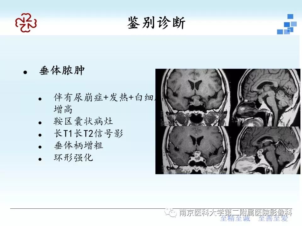 【PPT】垂体Rathke囊肿MRI表现