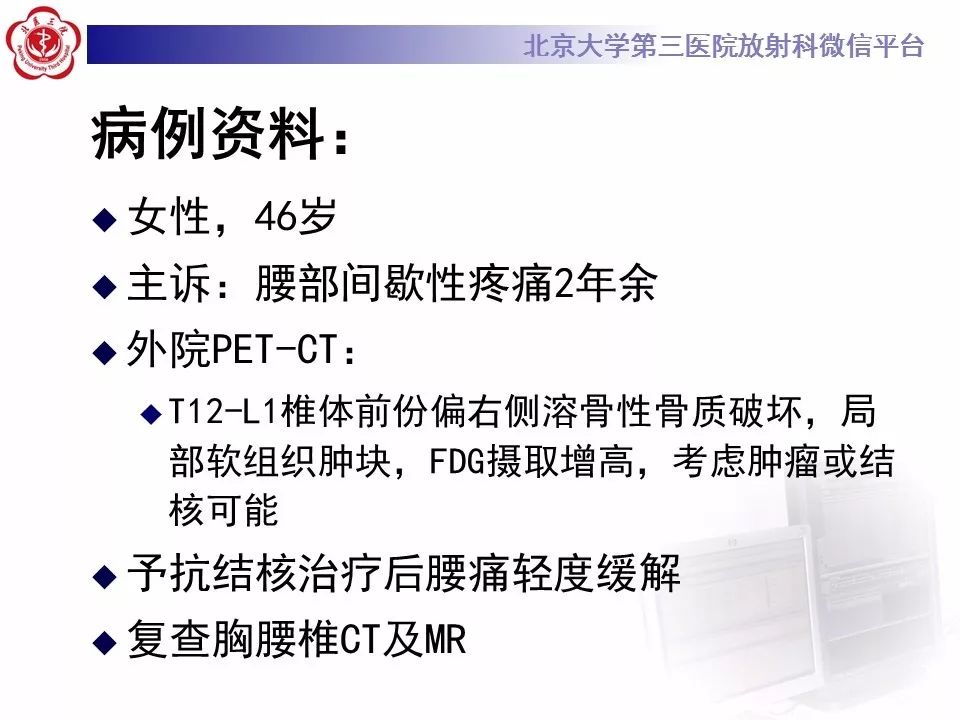 【病例】脊柱胚胎性横纹肌肉瘤1例CT及MR影像表现