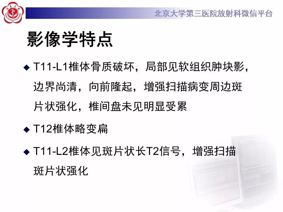【病例】脊柱胚胎性横纹肌肉瘤1例CT及MR影像表现