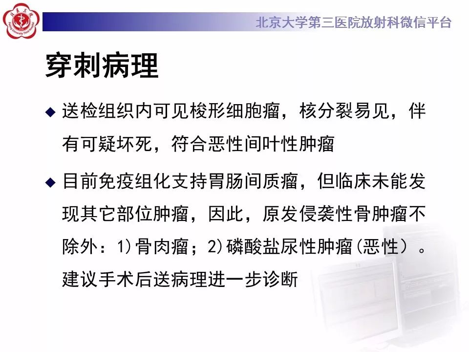 【病例】脊柱胚胎性横纹肌肉瘤1例CT及MR影像表现