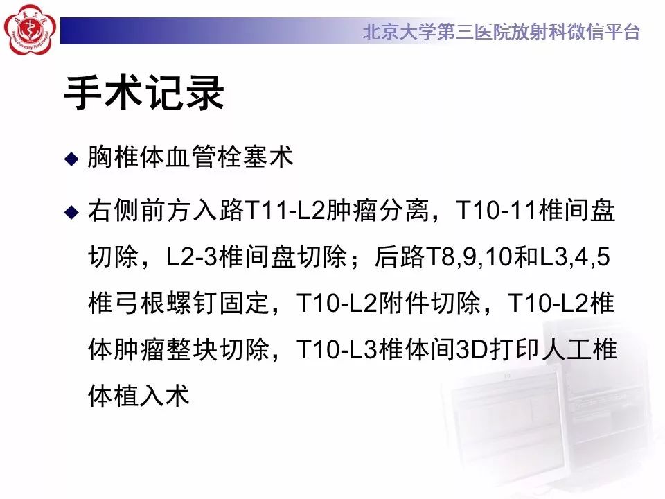 【病例】脊柱胚胎性横纹肌肉瘤1例CT及MR影像表现
