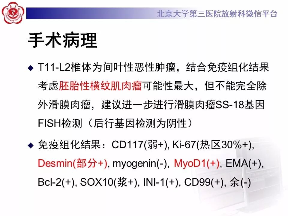 【病例】脊柱胚胎性横纹肌肉瘤1例CT及MR影像表现