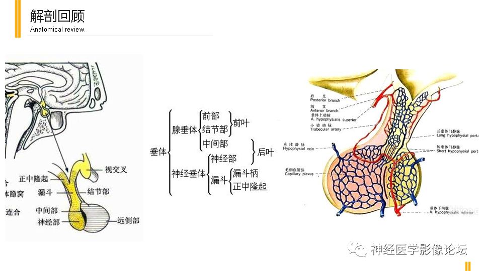 【病例】鞍旁孤立性纤维瘤/血管外皮细胞瘤1例CT及MR