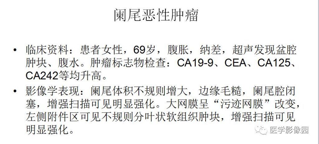 【病例】阑尾恶性肿瘤1例CT
