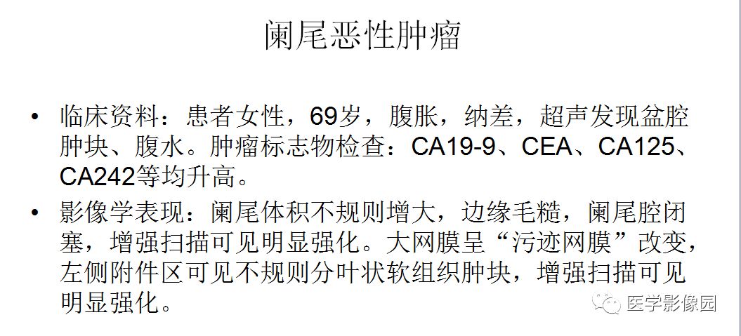 【病例】阑尾恶性肿瘤1例CT