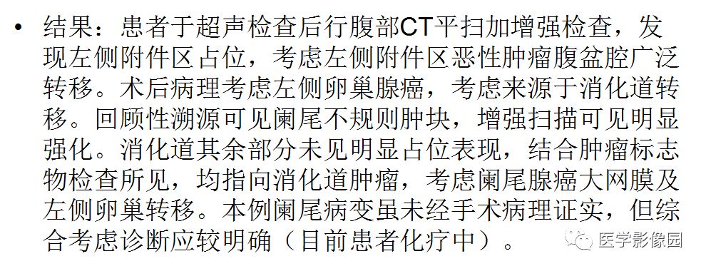 【病例】阑尾恶性肿瘤1例CT