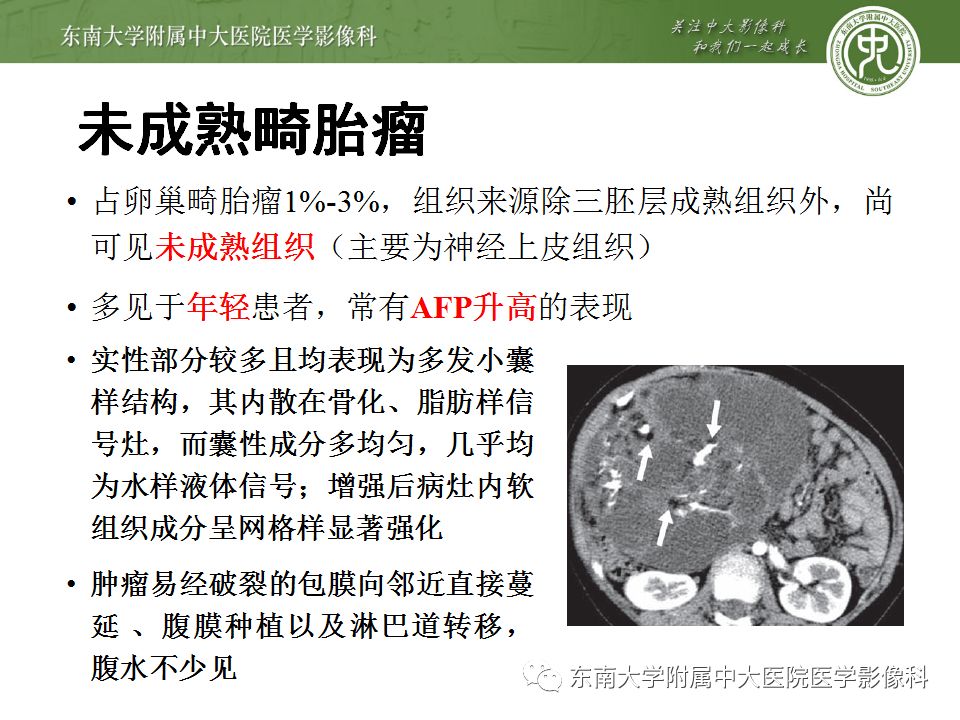 【病例】卵巢畸胎瘤VS囊腺瘤