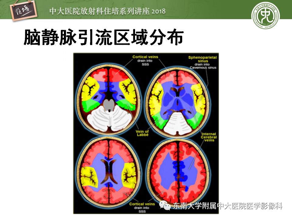 【PPT】脑静脉血栓影像表现及图像解读误区
