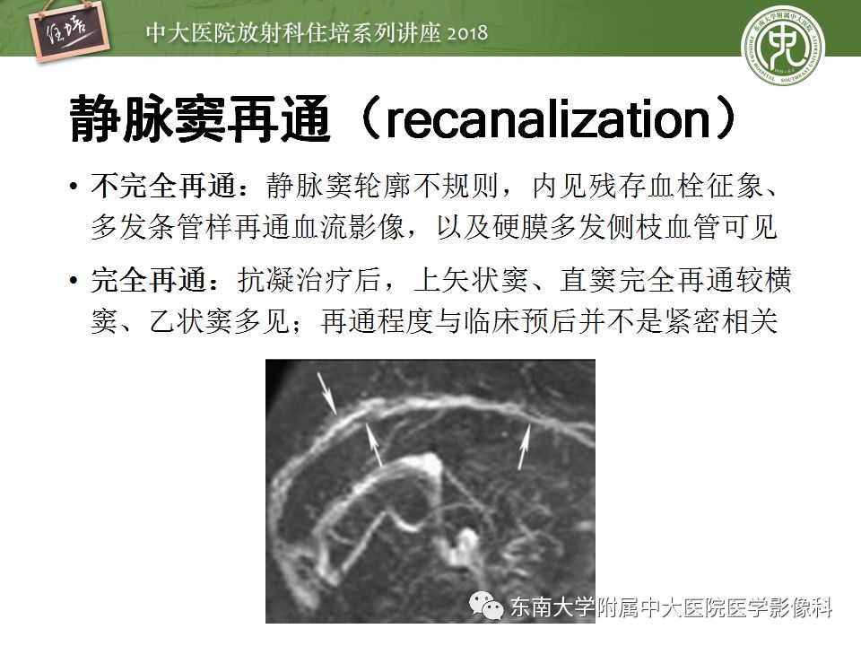 【PPT】脑静脉血栓影像表现及图像解读误区