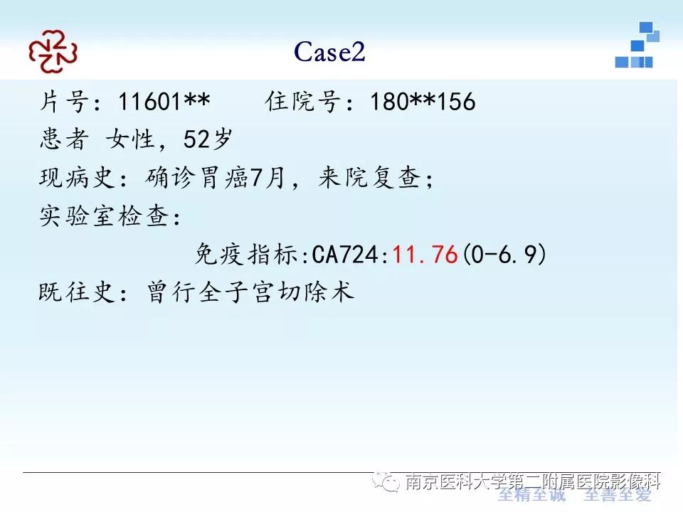 【PPT】胃黏液腺癌的多层螺旋CT表现