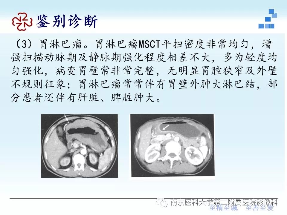 【PPT】胃黏液腺癌的多层螺旋CT表现