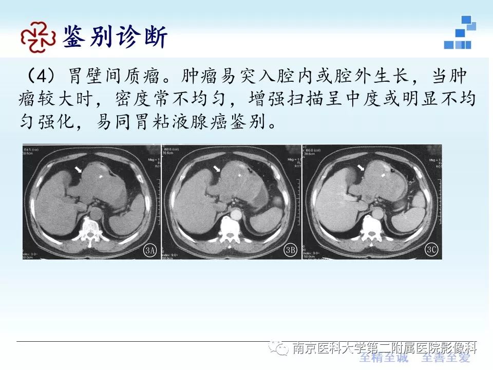 【PPT】胃黏液腺癌的多层螺旋CT表现