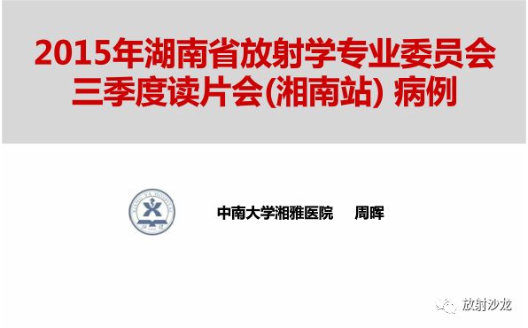 【病例】胸膜结核性肉芽肿1例CT