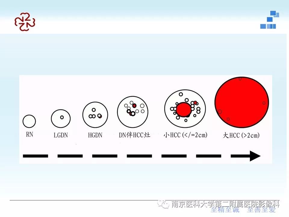【PPT】肝硬化结节