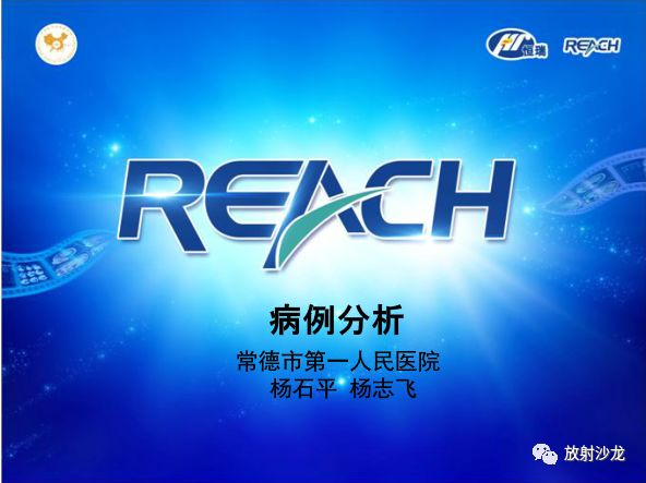 【病例】骶孔脊膜瘤1例MR影像表现