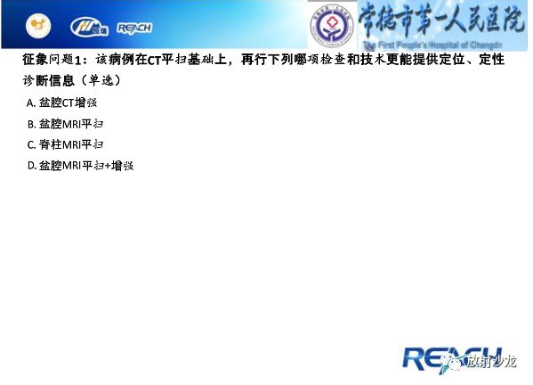 【病例】骶孔脊膜瘤1例MR影像表现
