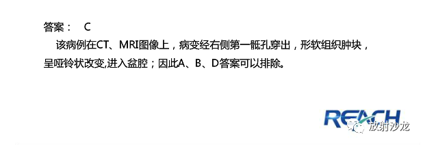 【病例】骶孔脊膜瘤1例MR影像表现