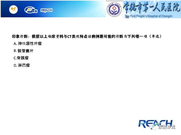 【病例】骶孔脊膜瘤1例MR影像表现