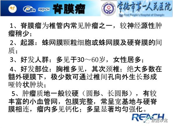 【病例】骶孔脊膜瘤1例MR影像表现