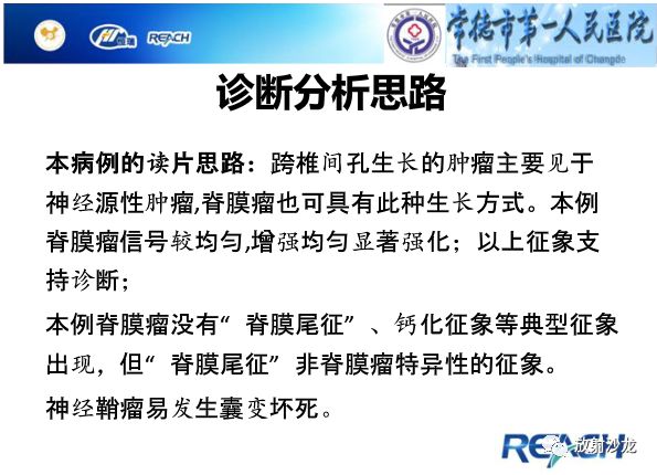 【病例】骶孔脊膜瘤1例MR影像表现