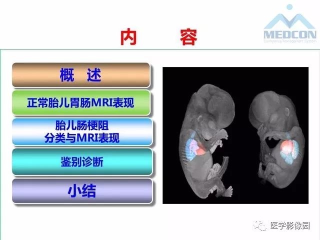 【PPT】胎儿肠梗阻：MRI表现与分析