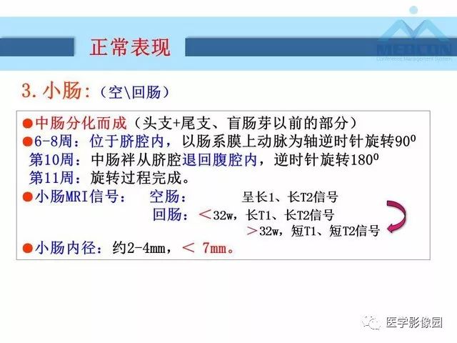 【PPT】胎儿肠梗阻：MRI表现与分析