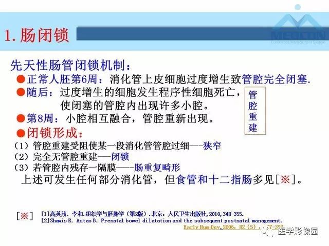 【PPT】胎儿肠梗阻：MRI表现与分析