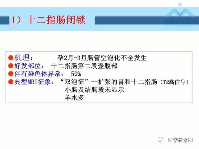 【PPT】胎儿肠梗阻：MRI表现与分析