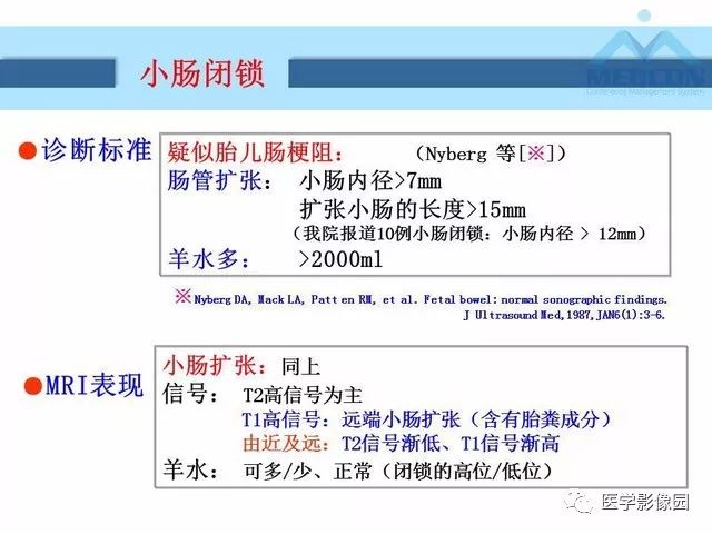 【PPT】胎儿肠梗阻：MRI表现与分析