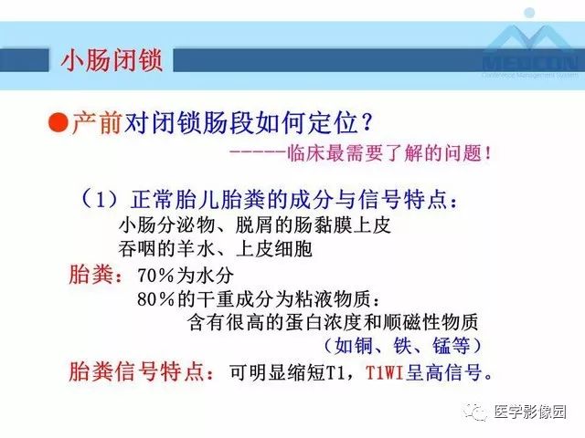 【PPT】胎儿肠梗阻：MRI表现与分析