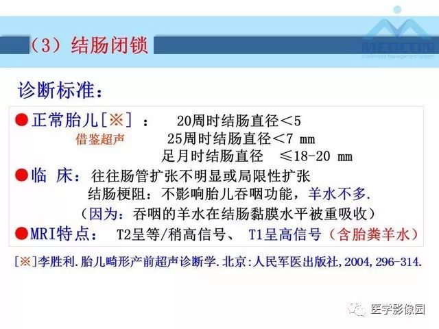 【PPT】胎儿肠梗阻：MRI表现与分析
