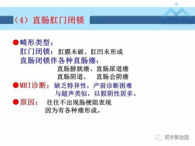 【PPT】胎儿肠梗阻：MRI表现与分析
