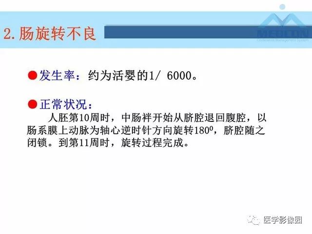 【PPT】胎儿肠梗阻：MRI表现与分析