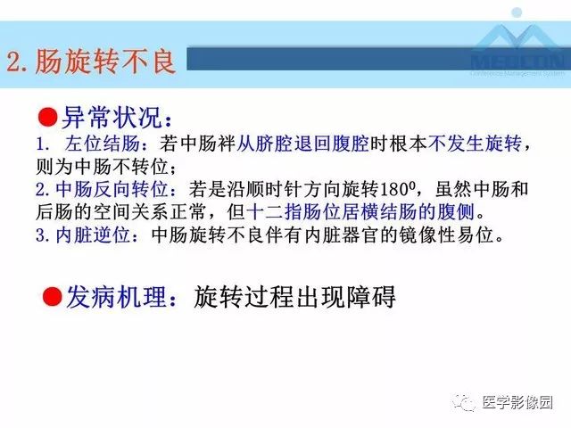 【PPT】胎儿肠梗阻：MRI表现与分析