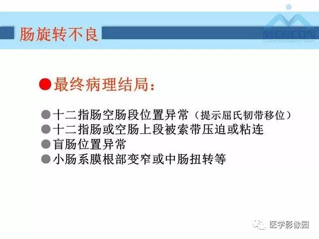 【PPT】胎儿肠梗阻：MRI表现与分析