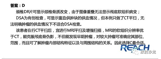 【病例】面神经鞘瘤1例CT及MR影像表现