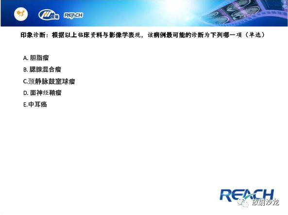 【病例】面神经鞘瘤1例CT及MR影像表现